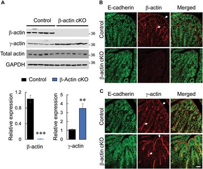 Loss of β-Cytoplasmic Actin in the Intestinal Epithelium Increases Gut Barrier Permeability in vivo and Exaggerates the Severity of Experimental Colitis